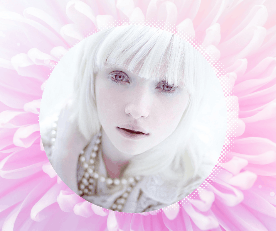 альбиносы